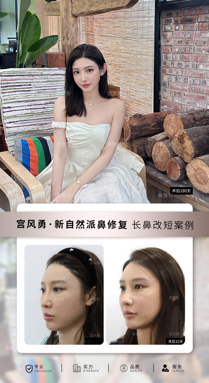 【#宫风勇新自然派美鼻# 长鼻改短思路】 鼻子在面部中庭占比过长