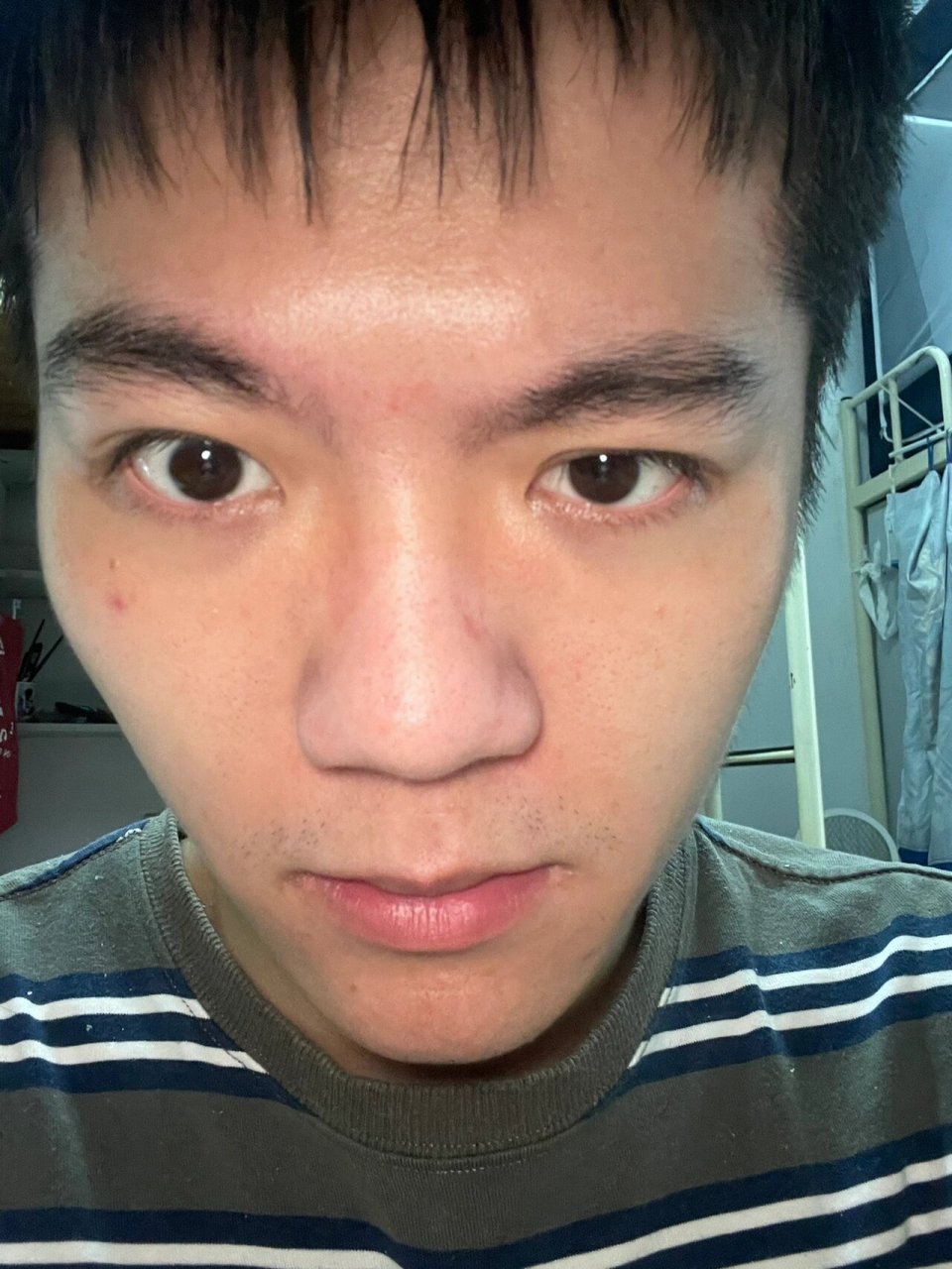 竟是这些原因7215 16615单侧咀嚼(经常用一边吃东西会导致
