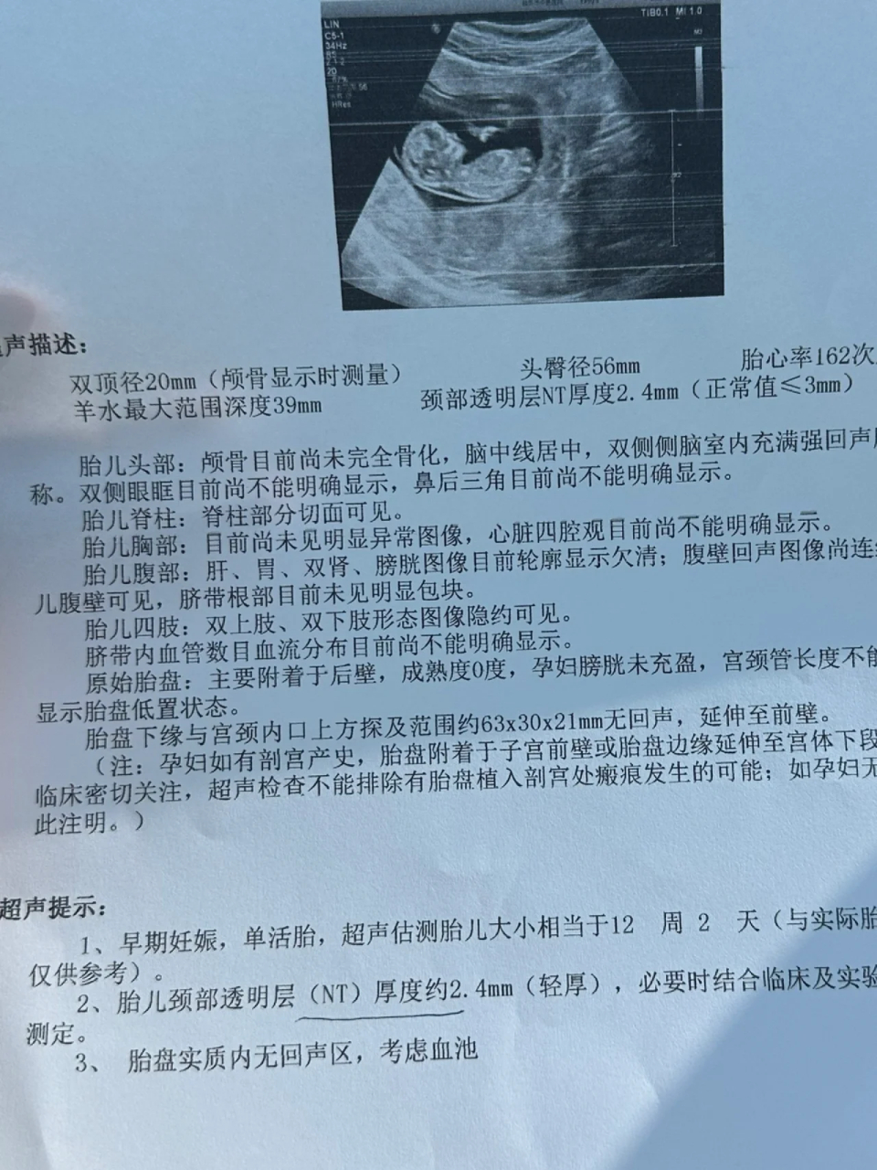 4在正常值边缘,非常焦虑,因为怀孕初期发烧感冒过两次,一直担心会有