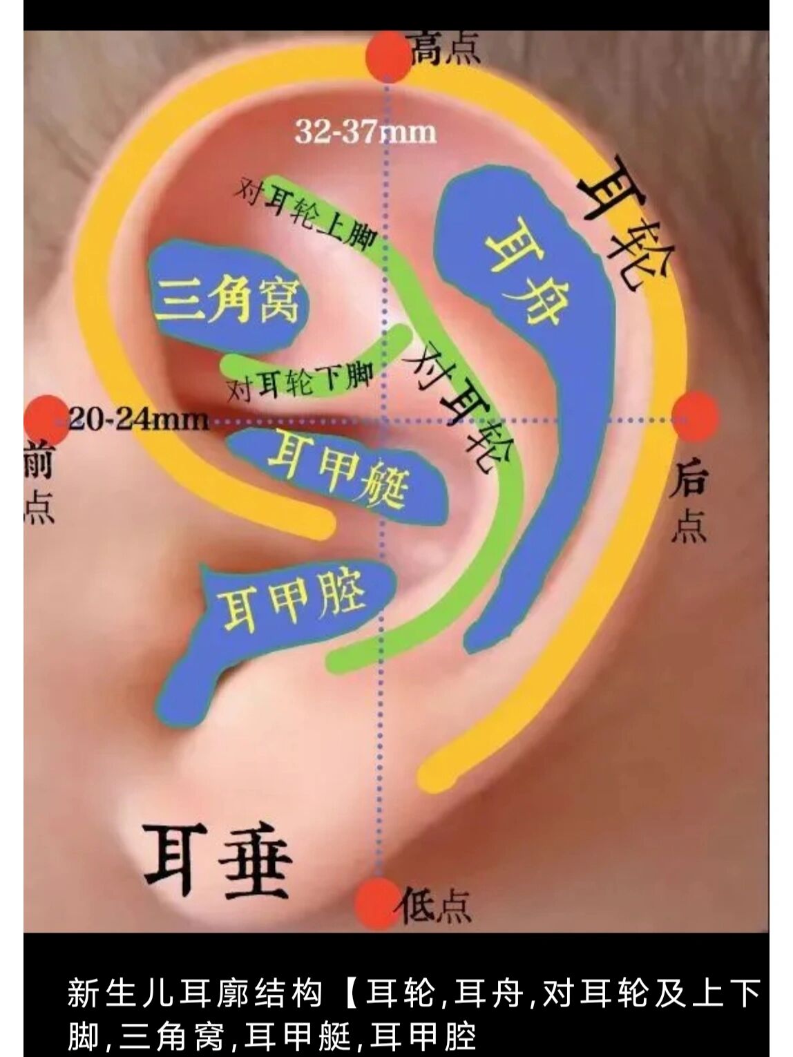 耳甲腔长了个疙瘩图片