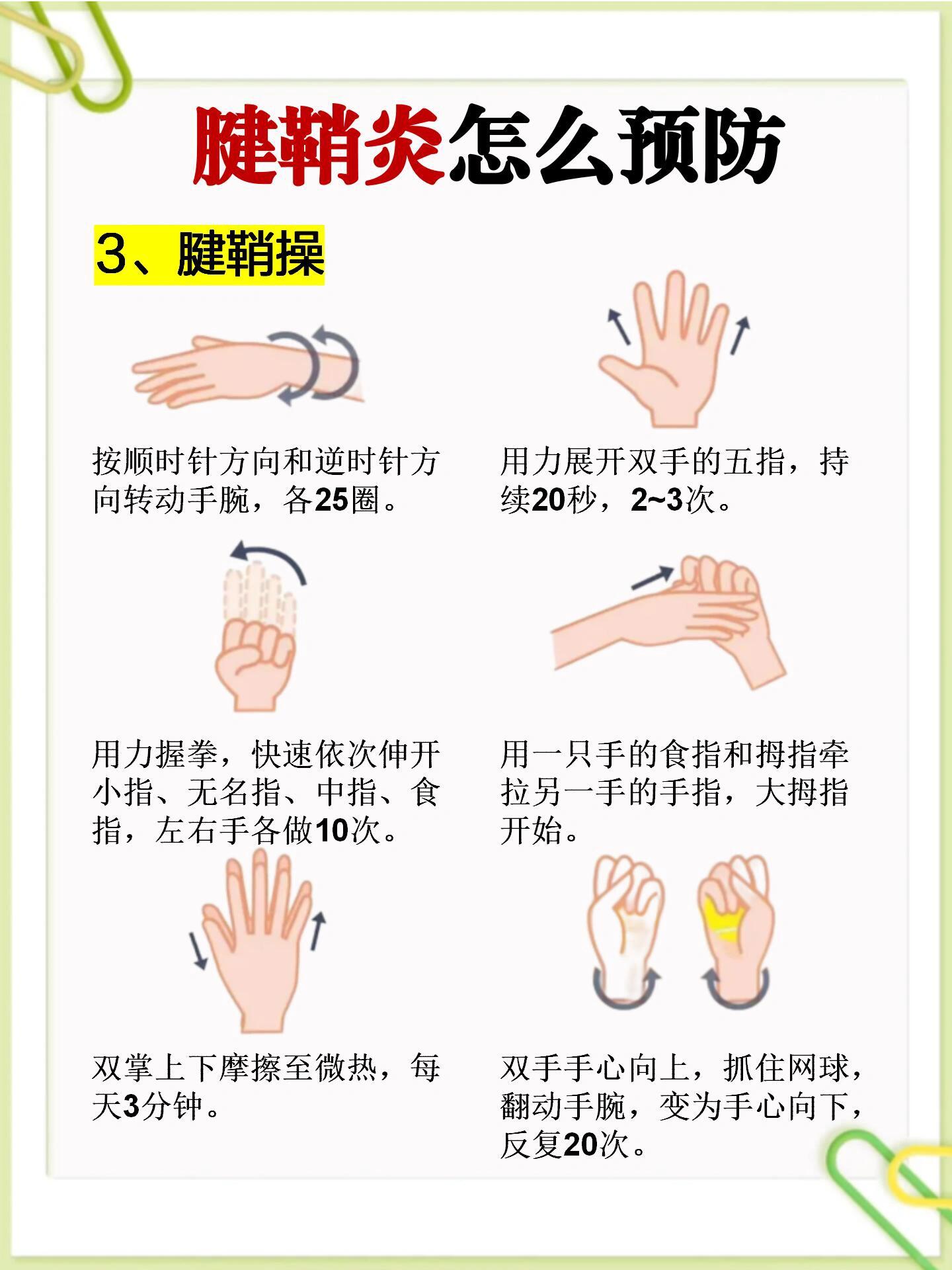 1分钟快速了解腱鞘炎症状 预防 治疗