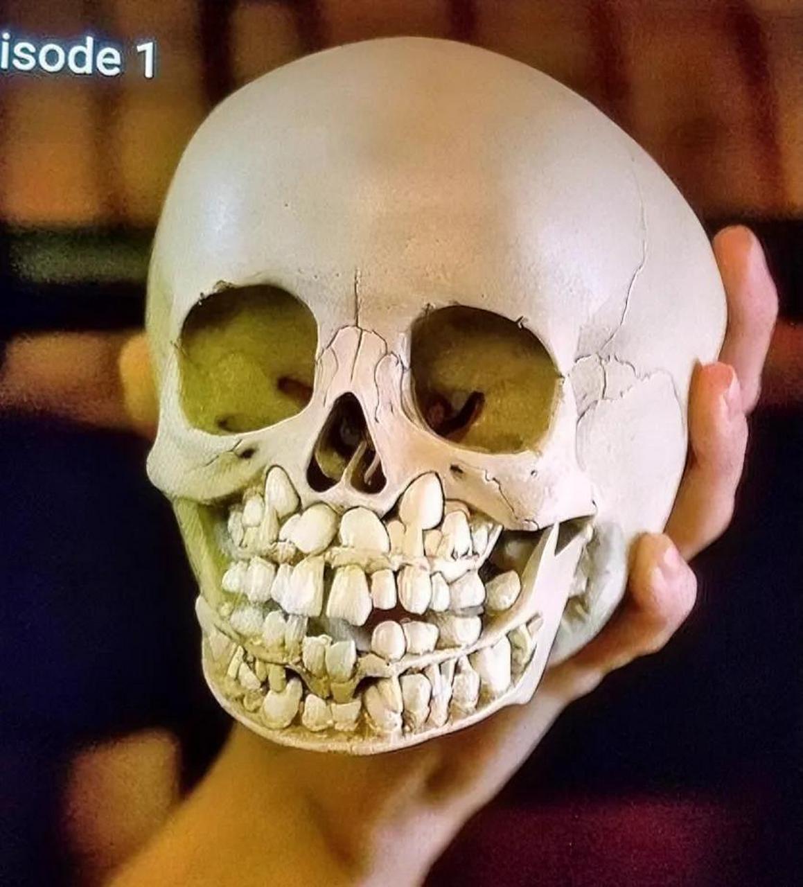 小孩的头骨全是牙齿图图片
