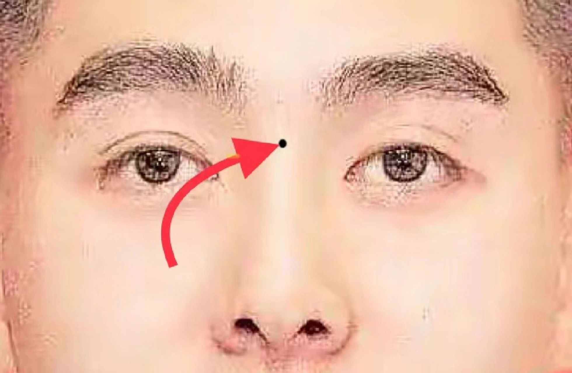 山根有痣鼻梁正面有痣 鼻梁正面有痣,40岁后 身体变差有小病痛.