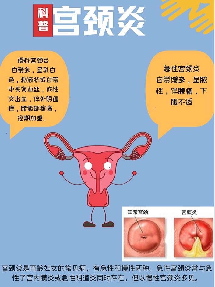 女性淋病下面 妇科图片