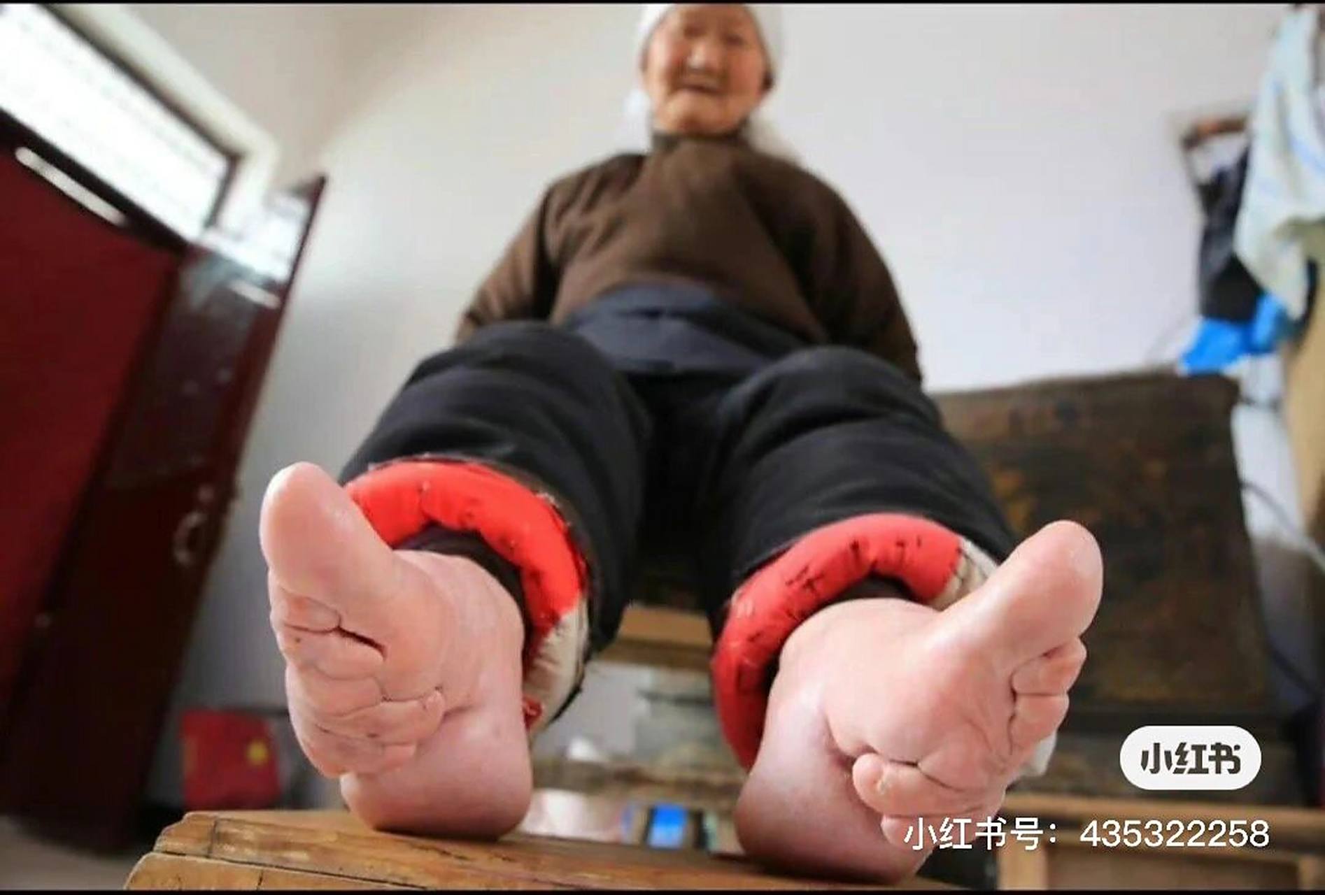 裹小脚,由来是什么,谁给古代女性带来灾害,痛苦,苦难!