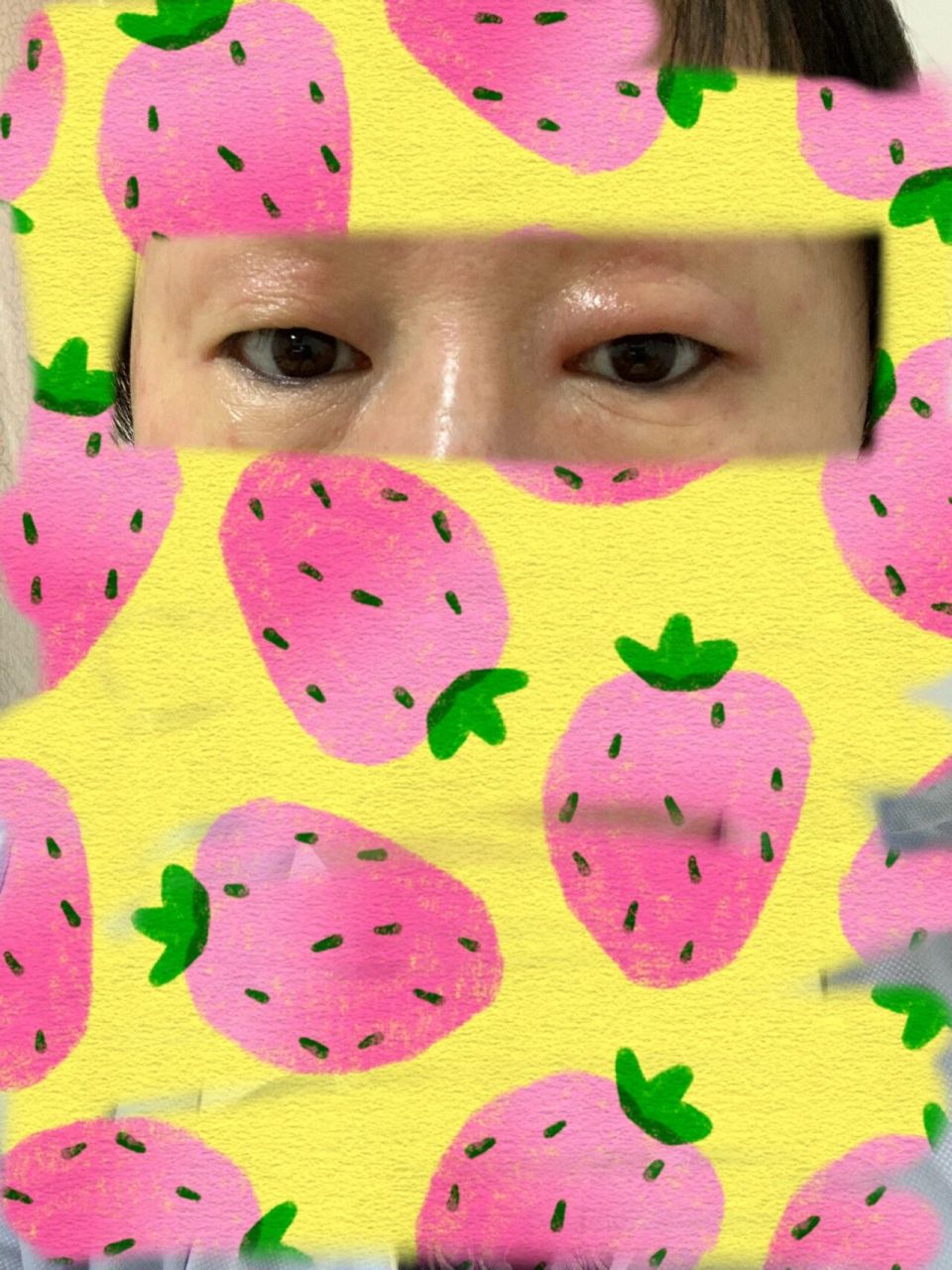 眼皮肿痒 两个星期前早上醒来右眼皮突然肿起来「眼睛明显睁不开,上