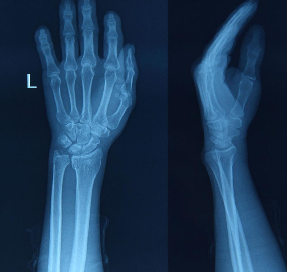 手腕用力或旋转时疼痛可能由多种原因引起