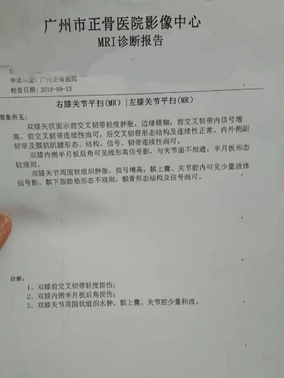 半月板损伤 三年多 跑步运动过度导致膝盖磨损