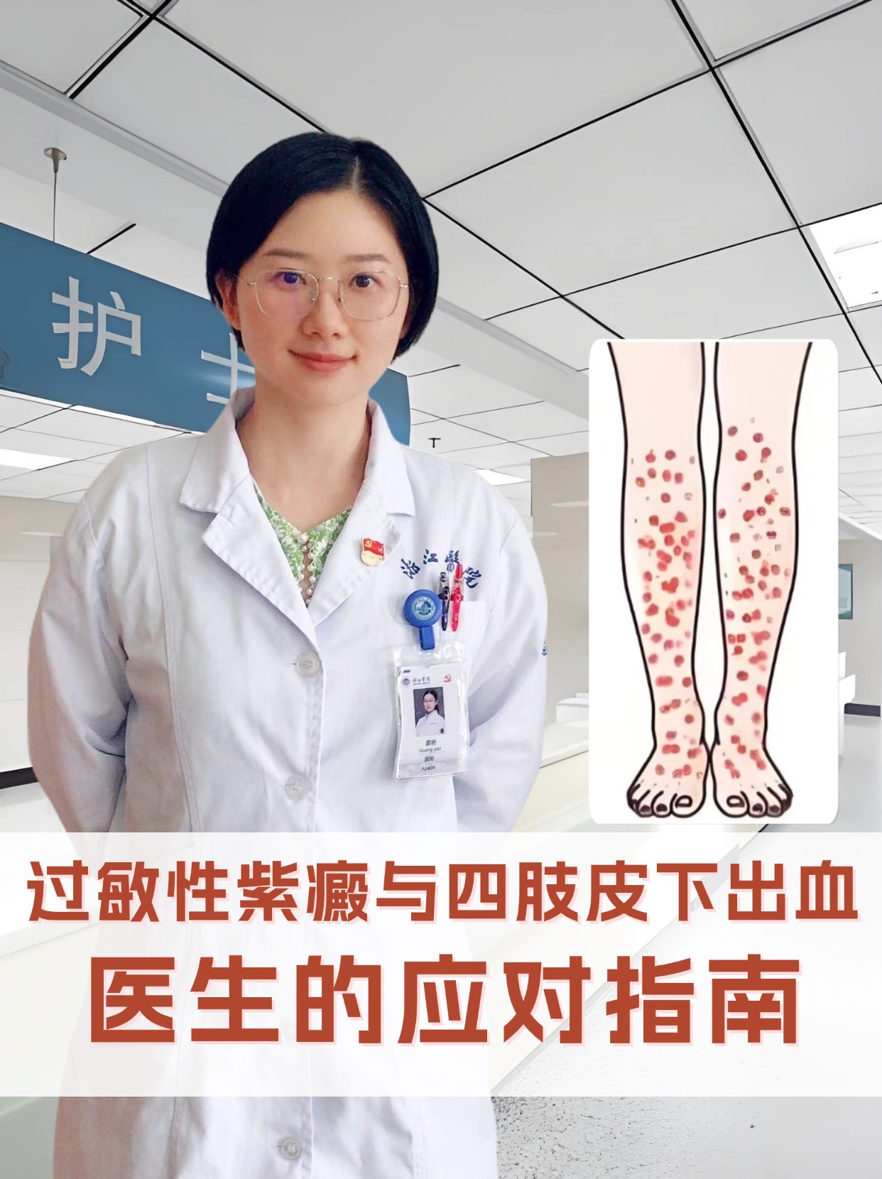 过敏性紫癜与四肢皮下出血:医生的应对指南 过敏性紫癜是一种血管变态