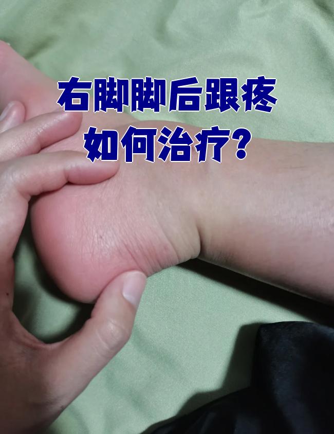 右脚脚后跟疼常见原因包括跟骨骨刺综合征,跟腱损伤和跟腱炎
