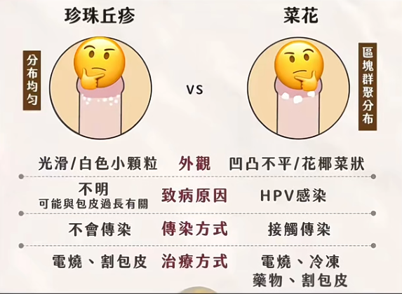 珍珠疹也叫珍珠状阴茎丘疹,主要长在阴茎冠状沟和龟头边缘