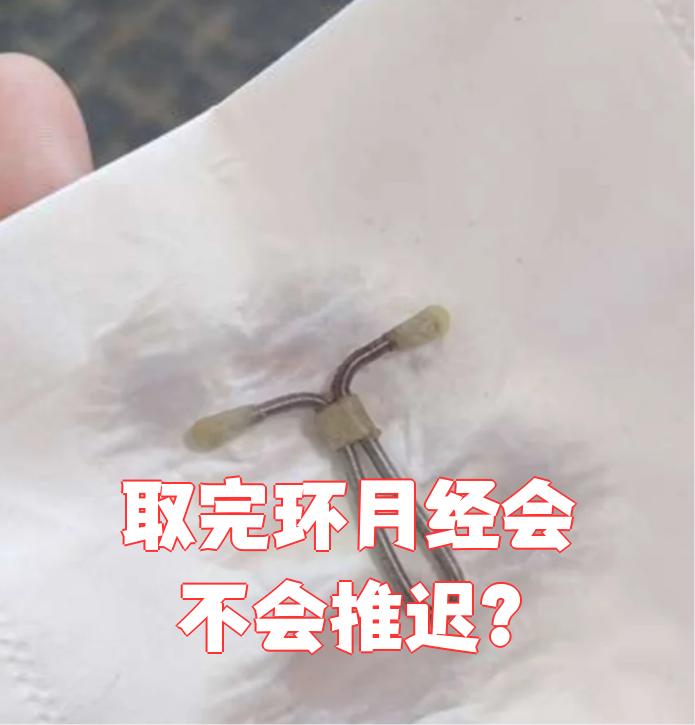 取环后月经一般不会推迟,但如果出现怀孕,子宫内膜损伤或宫颈粘连等