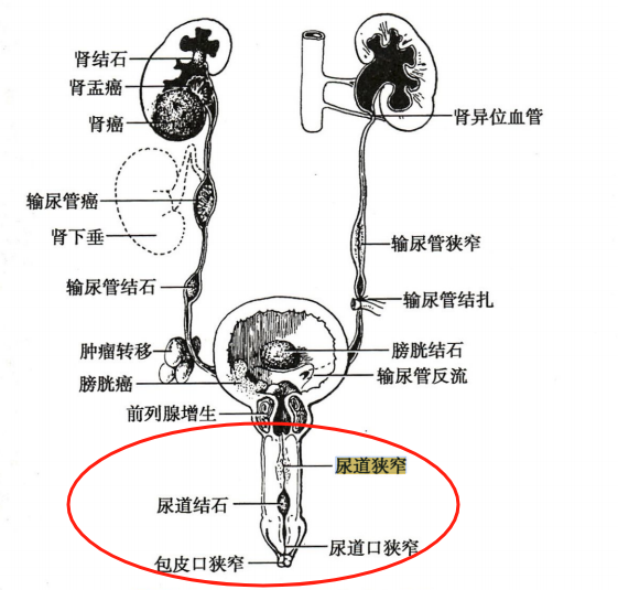 从解剖结构看,男性尿道分为三部分