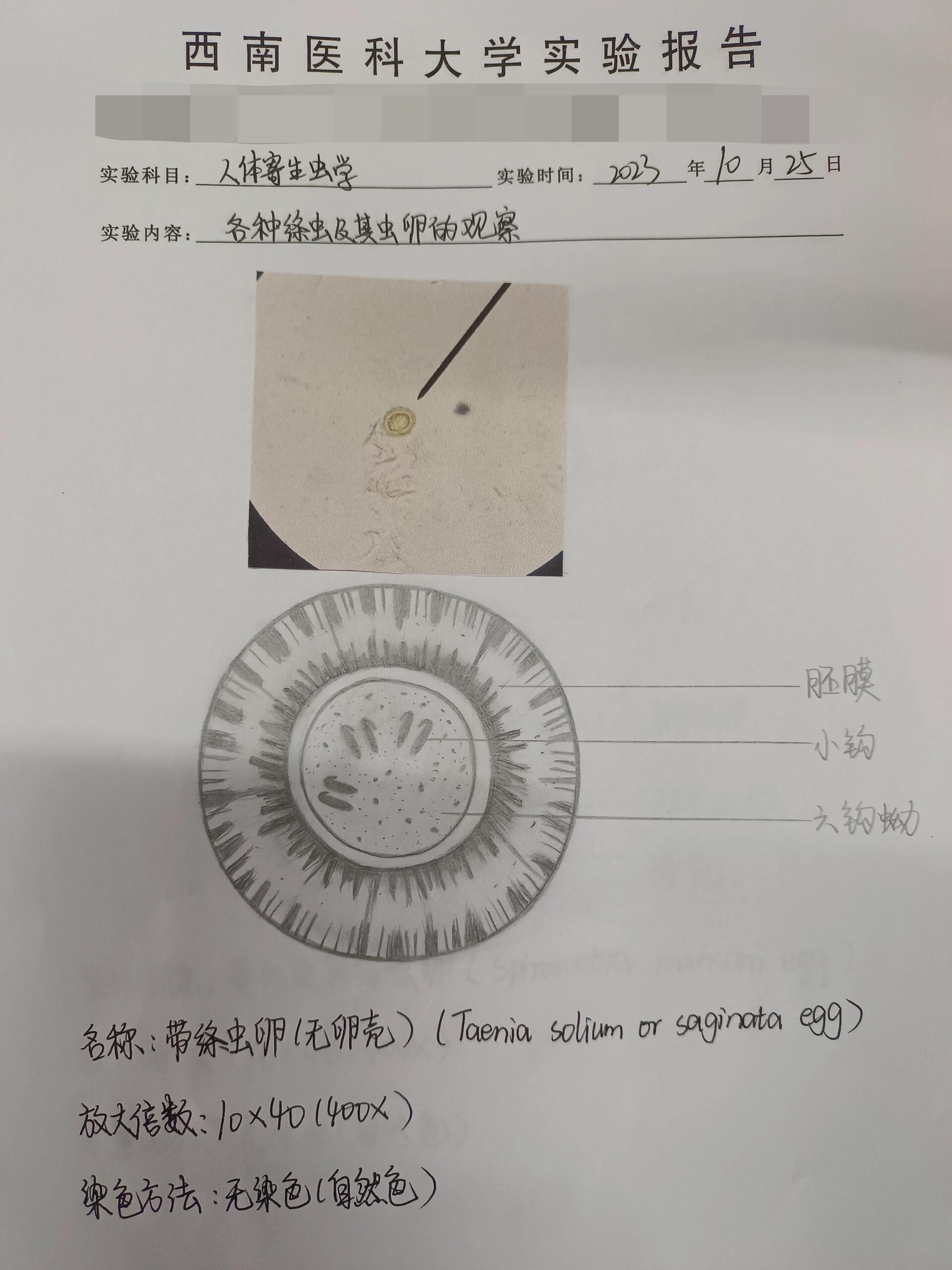 绦虫卵手绘图片