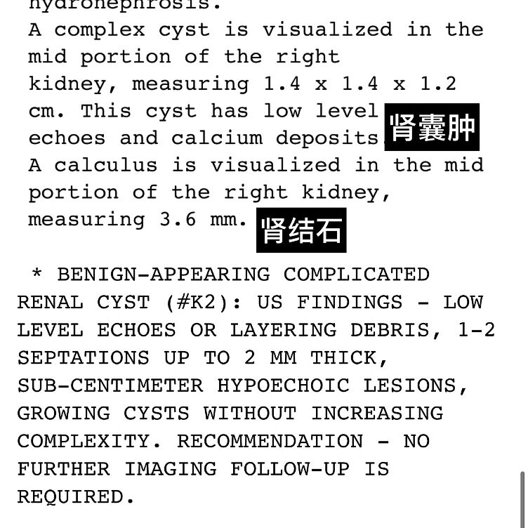 复杂性肾囊肿图片