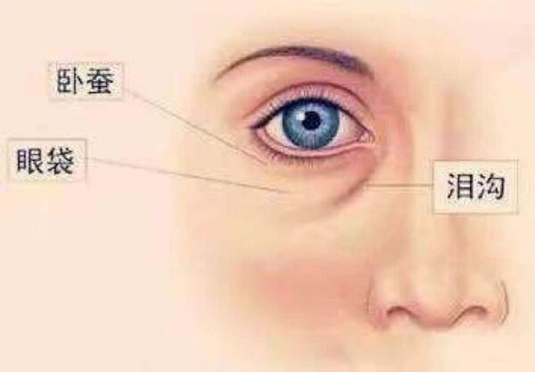 什么是泪沟? 25岁以后人体皮肤胶原蛋白开始流失,开始逐渐衰老.大多数