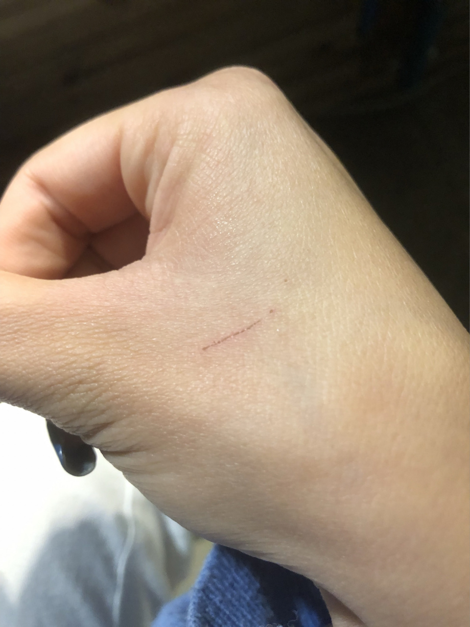 刚收养了两周的流浪猫,打了驱虫,去医院查了抗体很强,不需要打疫苗的