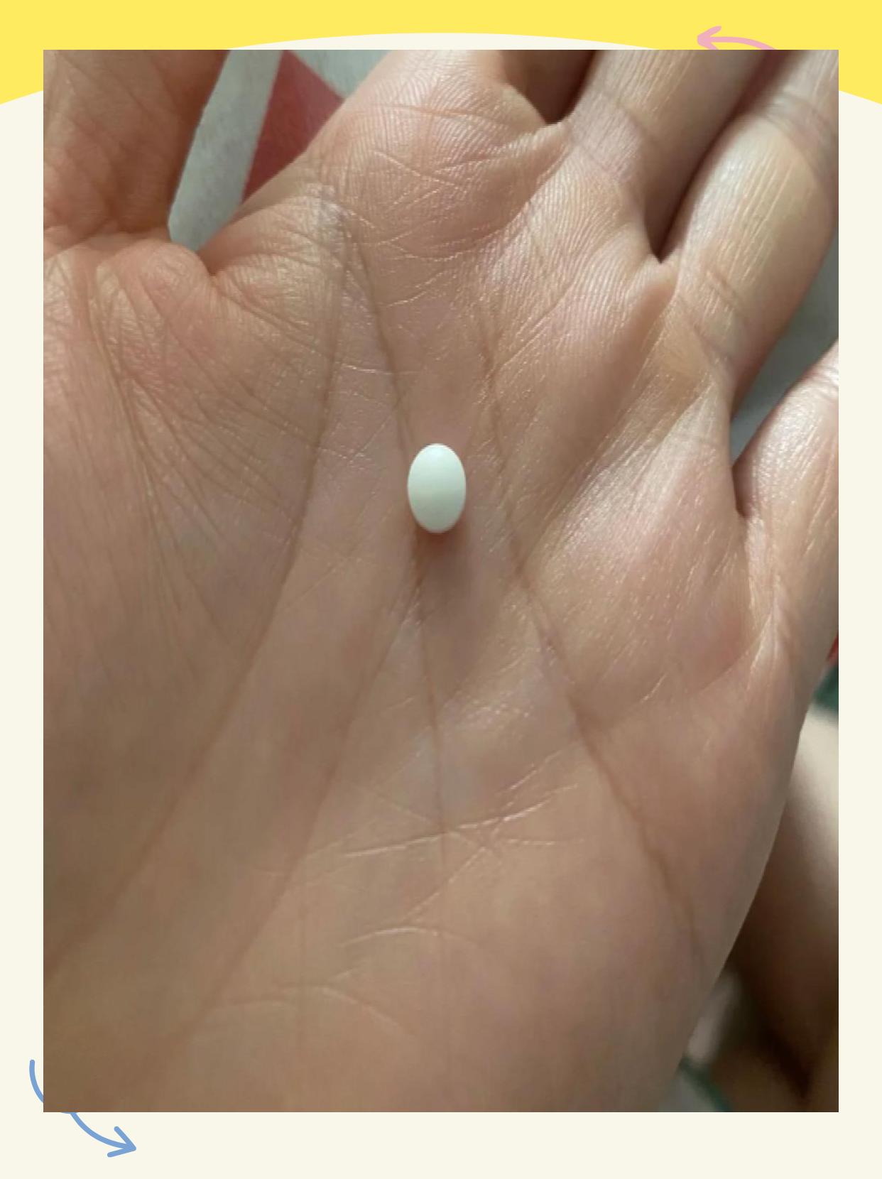 怀孕10周时胎儿长约3