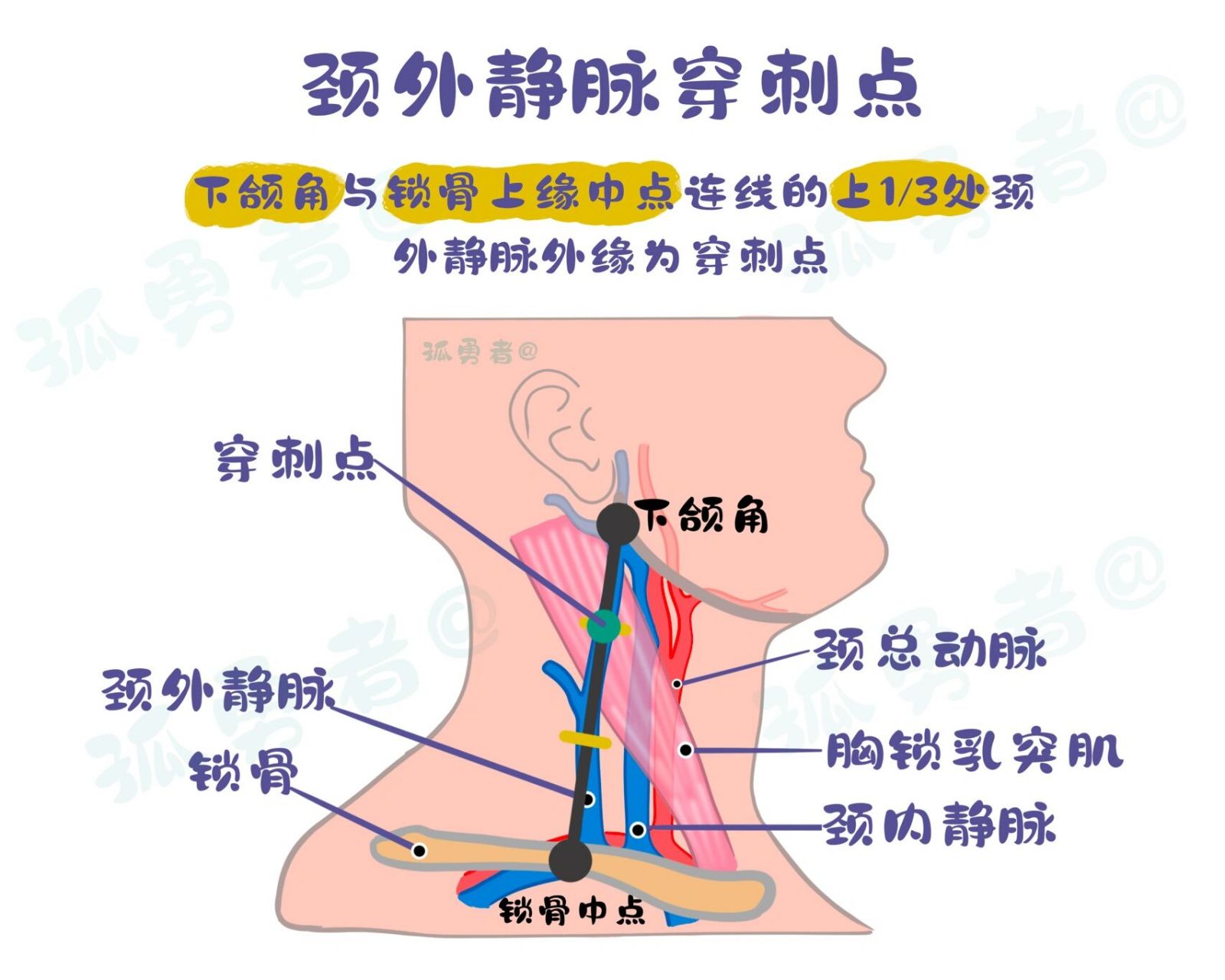 颈静脉位置示意图图片