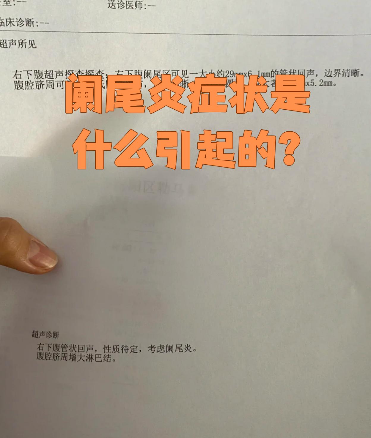 阑尾炎症状最常见的原因是阑尾管腔堵塞和细菌感染