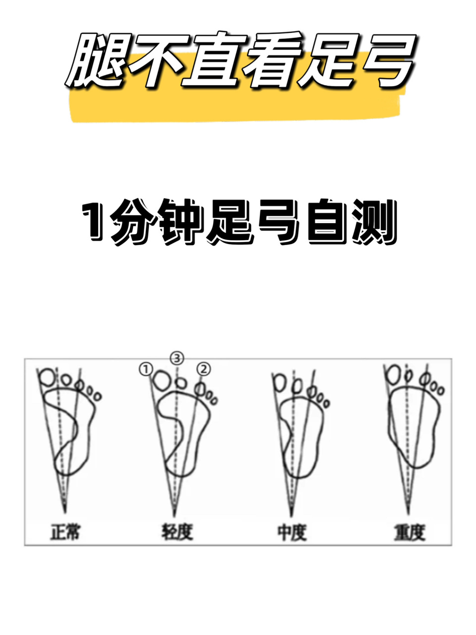 对照图三就可以大致判断自己的足弓情况.