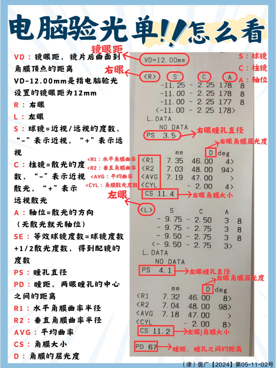 一篇笔记带你看懂眼科检查报告单