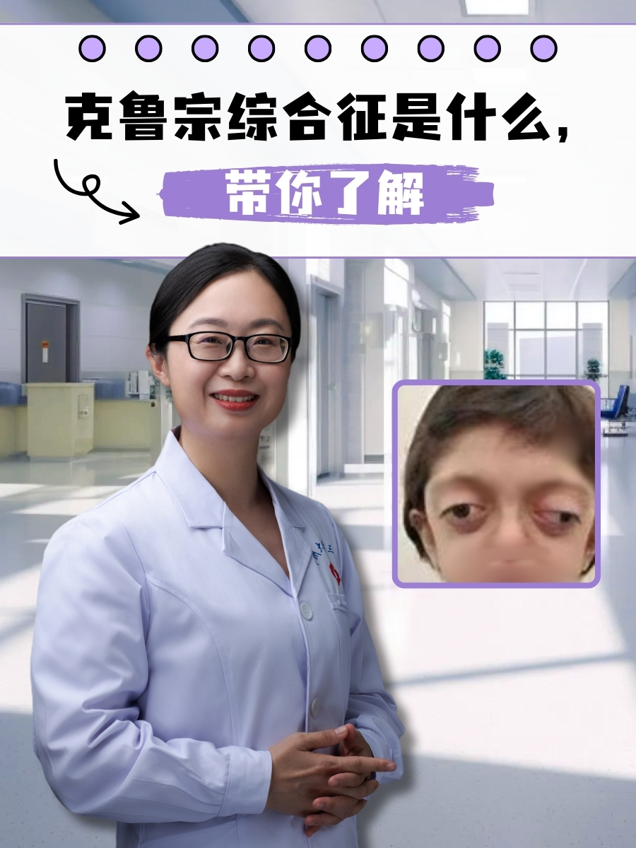 克鲁宗综合征是什么,带你了解 在众多的儿童罕见病中,克鲁宗综合征是