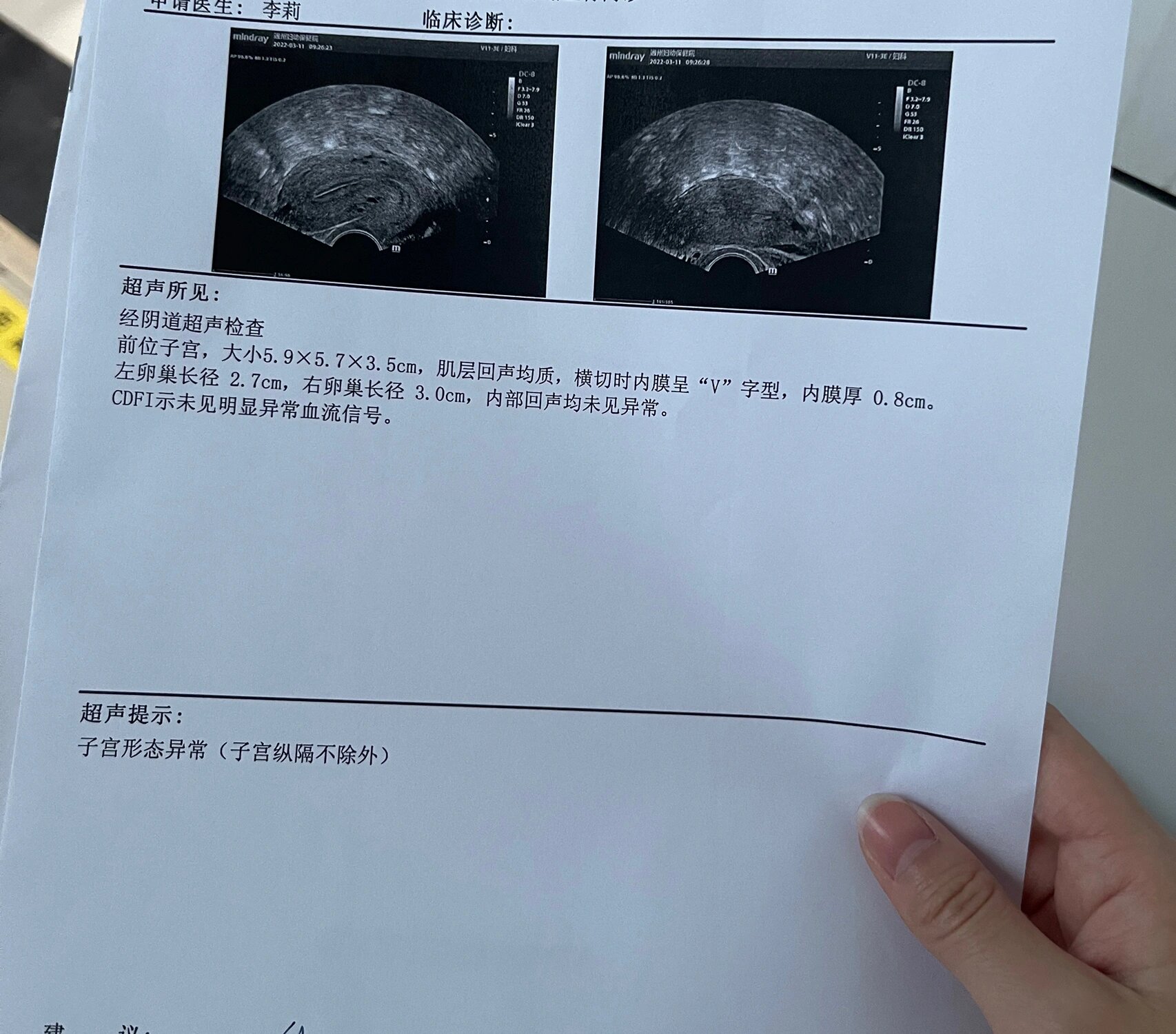 b超看不出来子宫纵隔吗? 准备备孕了,所以去做了孕前体检.