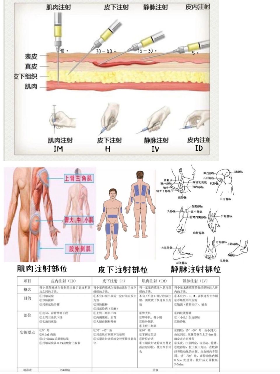 实习不尴尬/一张图学会四种注射!
