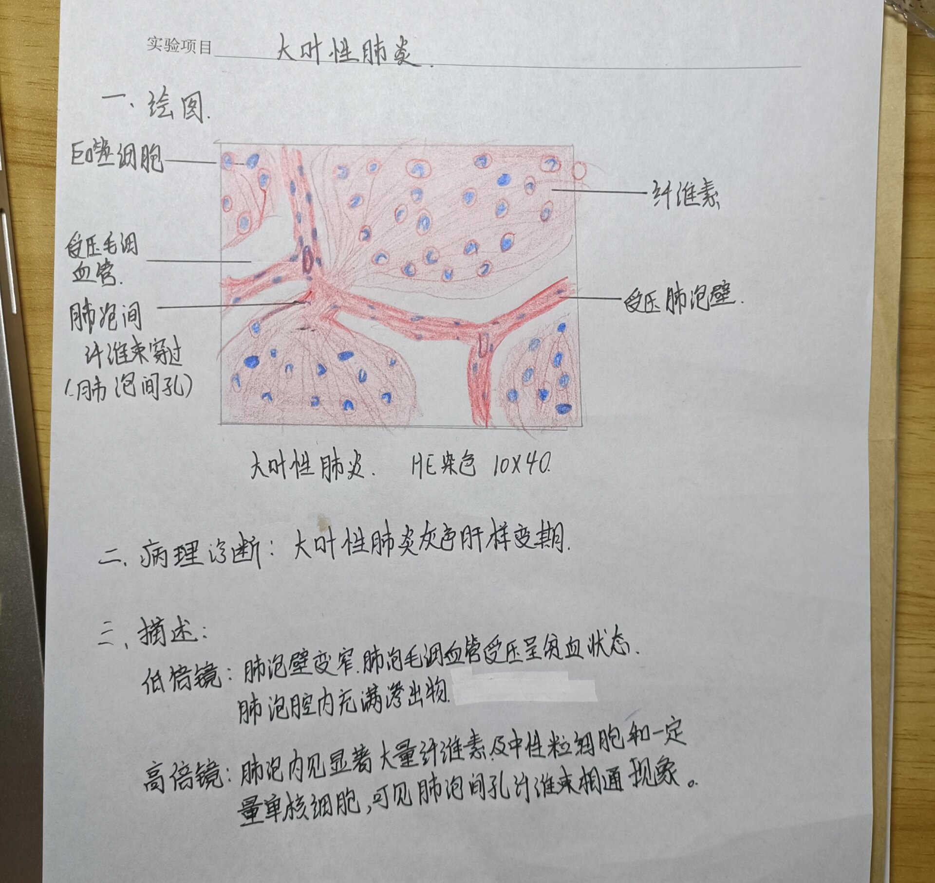 中动脉光镜结构图手绘图片