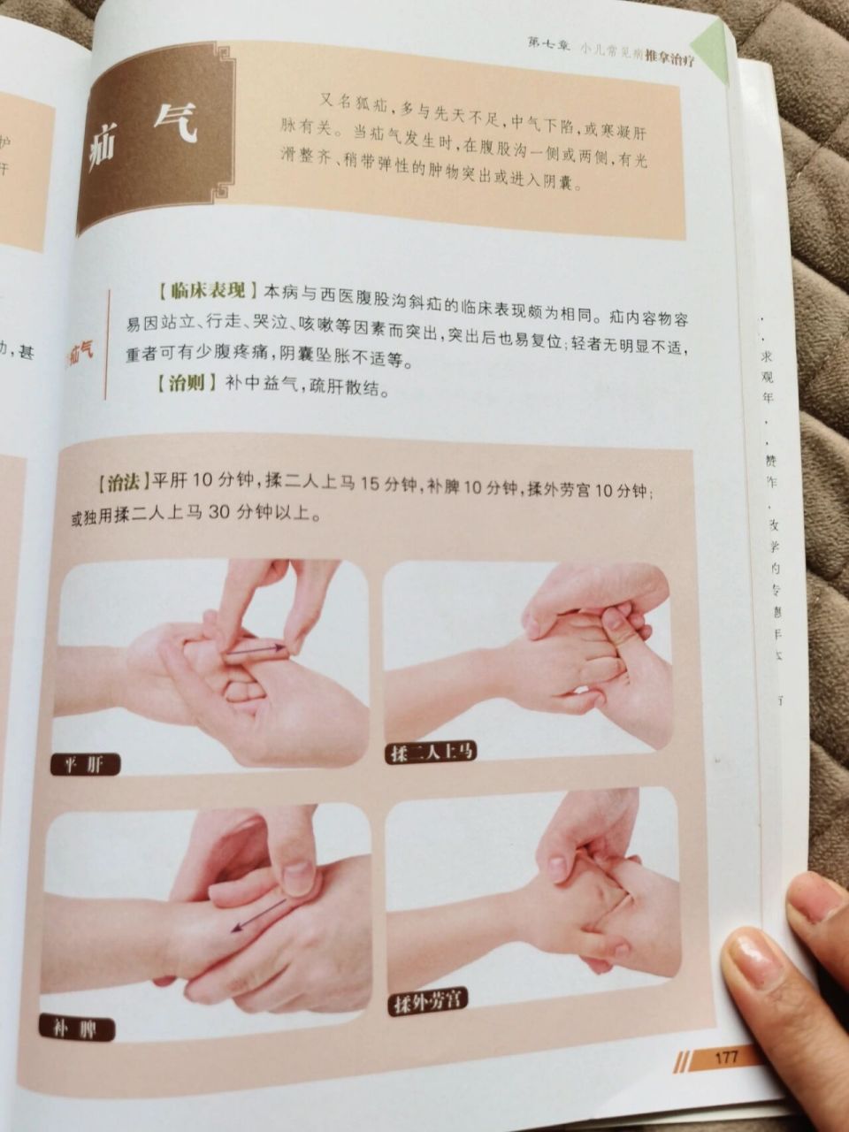 宝宝疝气 ,鞘膜积液的推拿方法 之前发的给自家宝宝