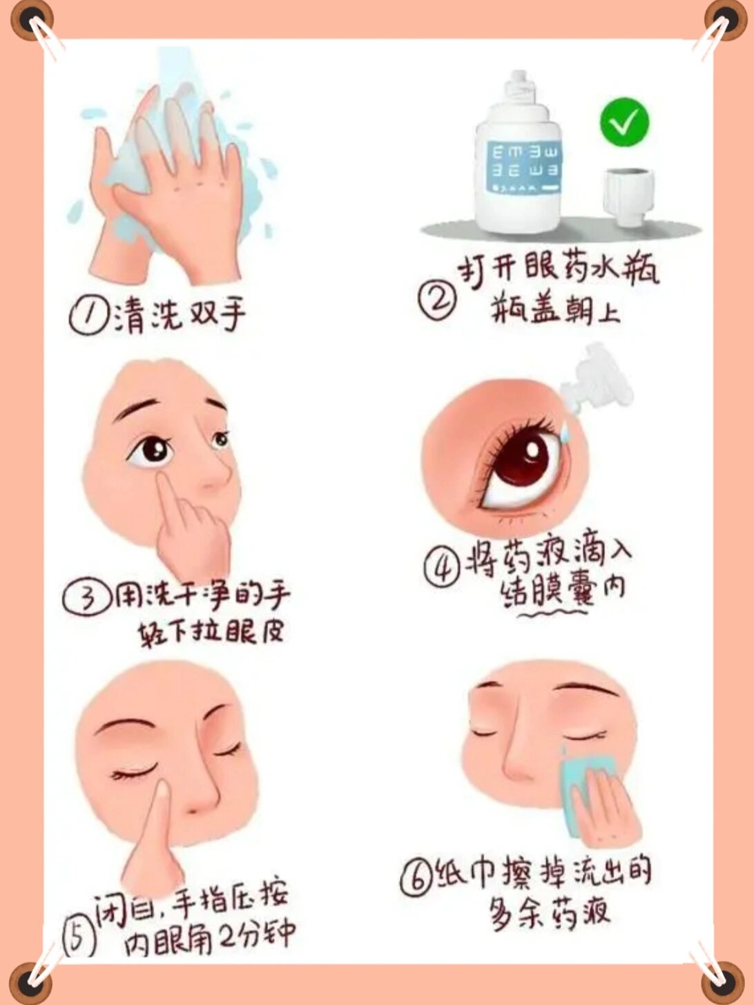 眼药水怎么滴,看看你的方法正确的吗?99