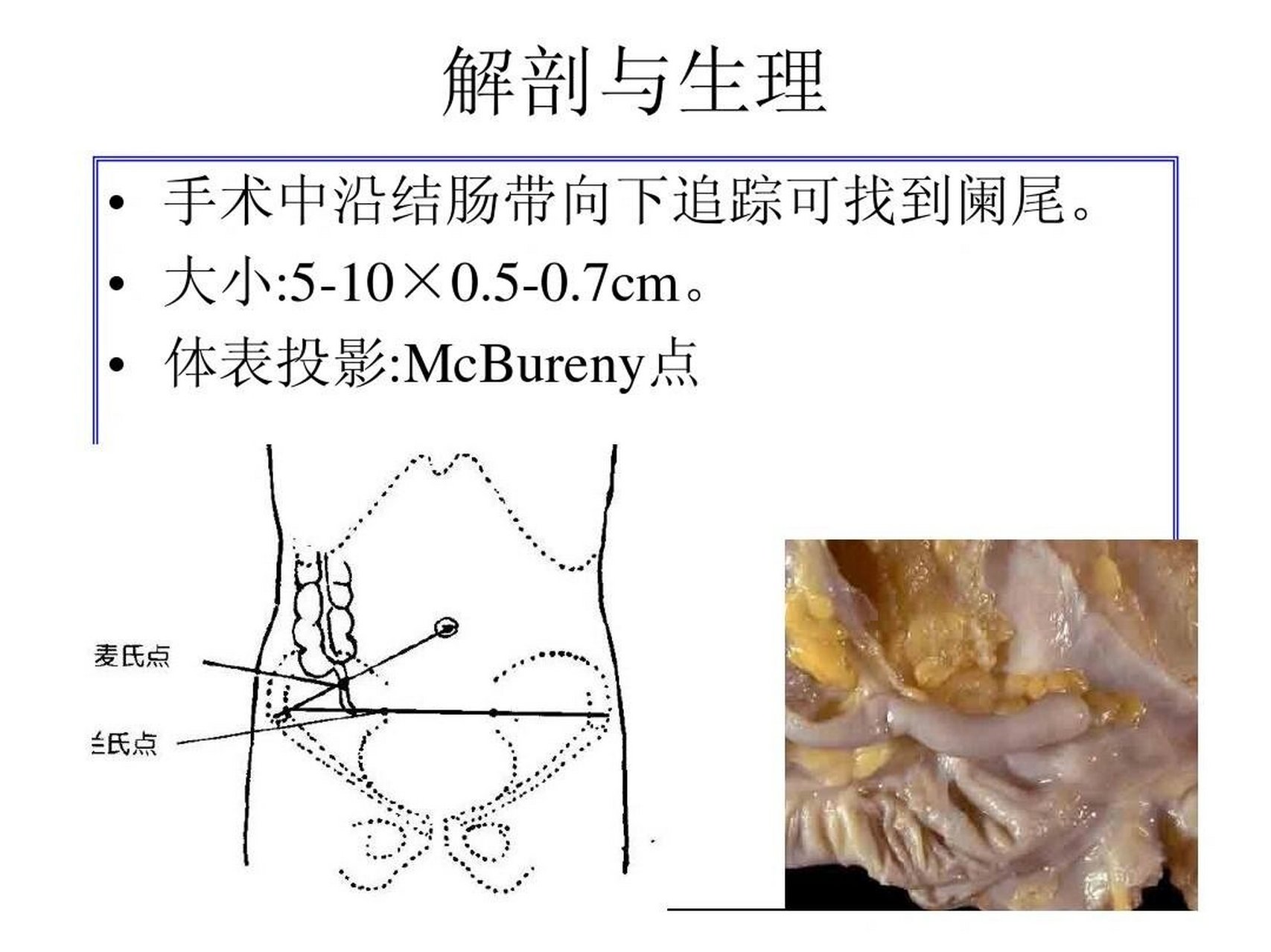 考研/运动解剖学/麦氏点 位置:脐与右髂前上棘连线的中,外1/3交点处