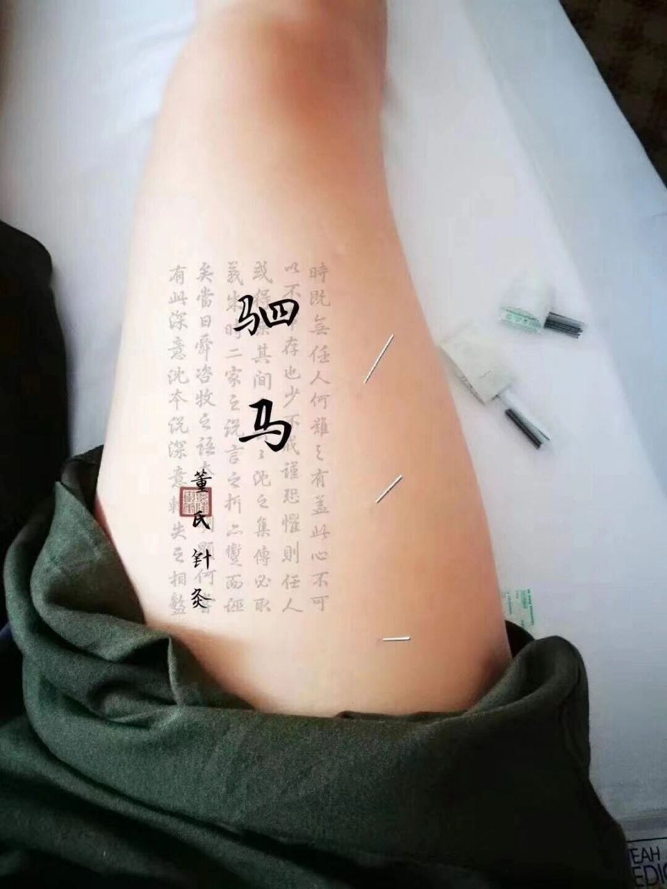 识穴第40篇|【驷马穴】肺炎,鼻炎,中耳炎 【董氏针灸·驷马穴】 胁肋