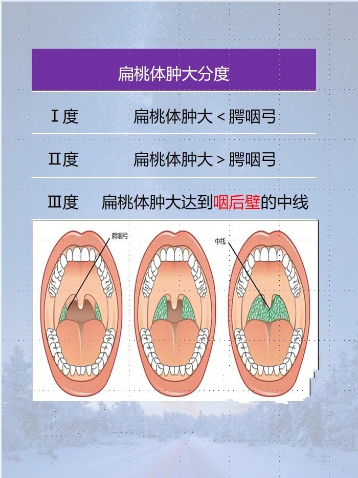 甲状腺肿大分度图片