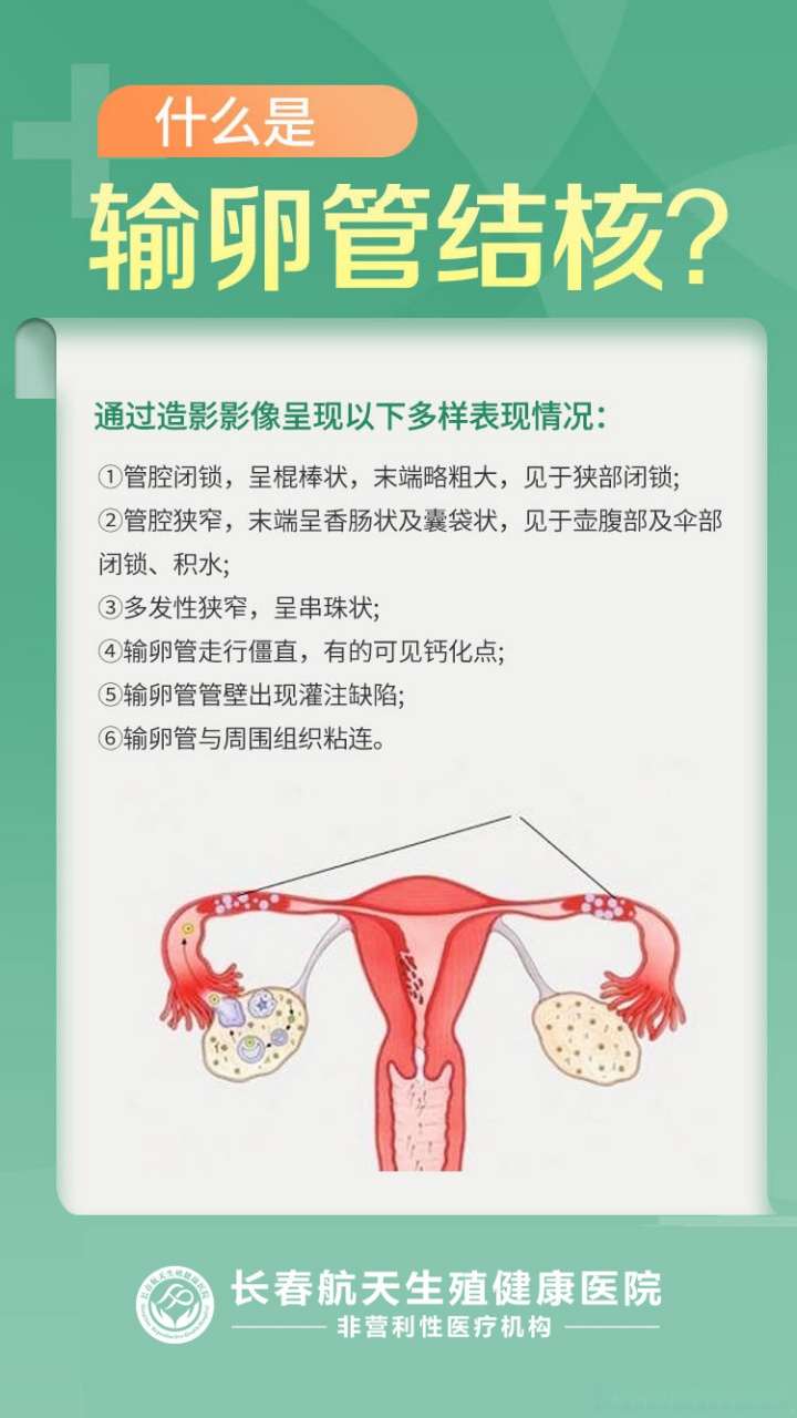 长春不孕不育医院#长春航天不孕不育医院专家解答:什么是输卵管结核