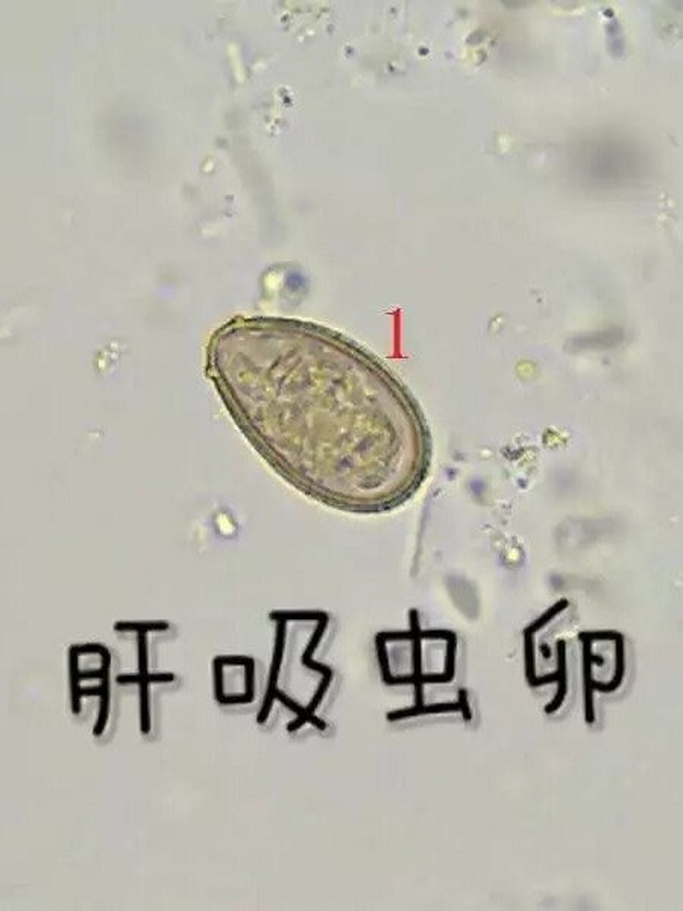 肝吸虫卵— 《人体寄生虫学》