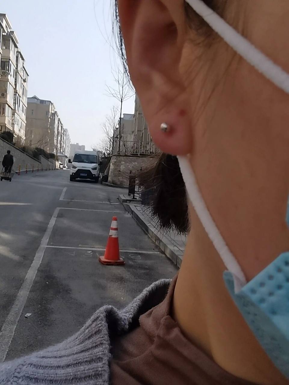 打耳洞换钉之后开始红肿 打了第五天,前几天一直一点都不疼,不红不肿