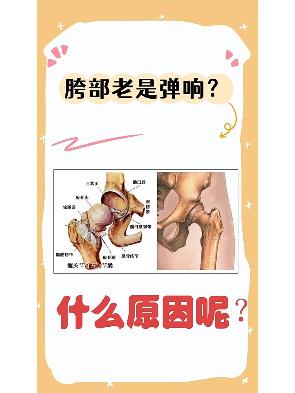 髋部经常弹响,原因究竟是?