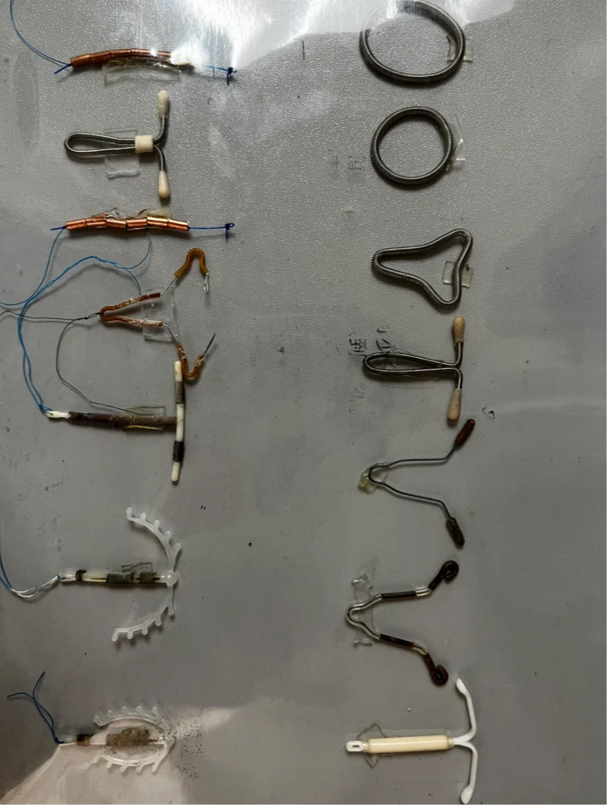 避孕环主要有三种类型:普通钢环,吉尼环和带孕激素的环