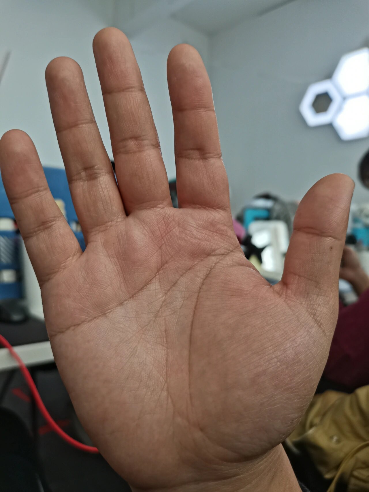 手掌有红白斑点是身体哪里出现问题?