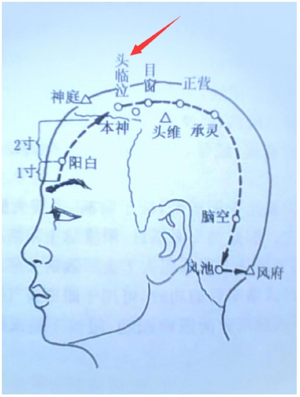 头临泣图片