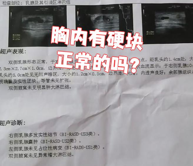 胸内有硬块正常的吗?