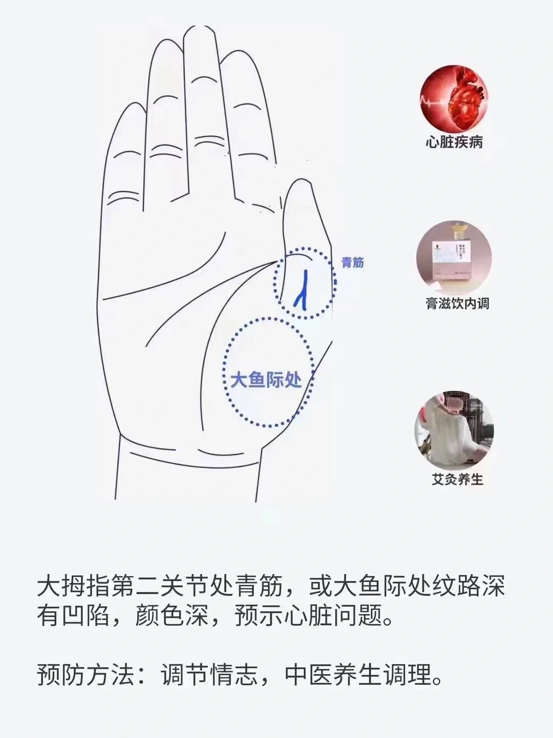 手诊基础知识 78手部青筋 大拇指第二关节处青筋,或大鱼际处纹路深