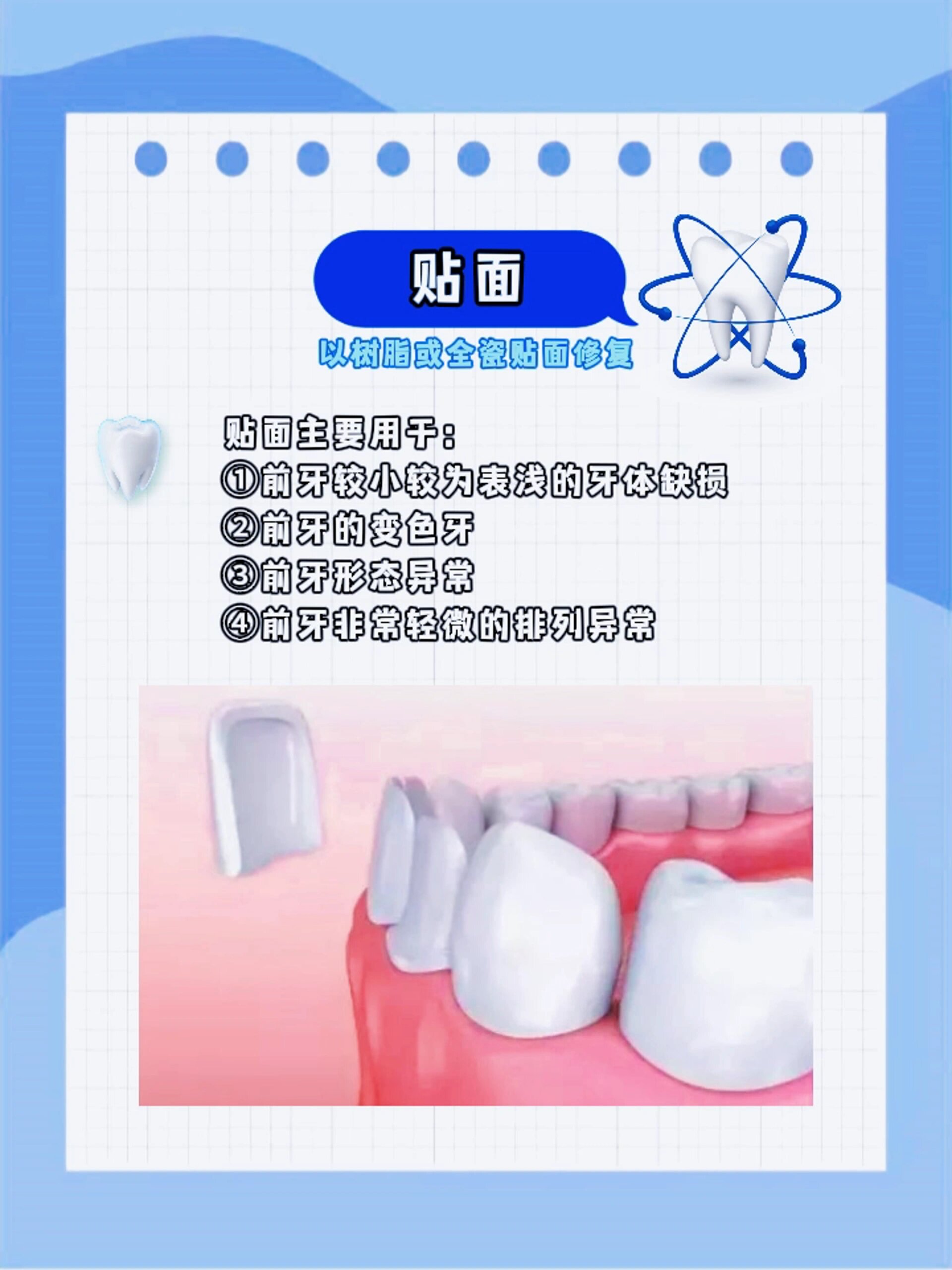 其实,牙齿残冠的边缘,会像利刃一般摩擦口腔黏膜,引发创伤性口腔溃疡.