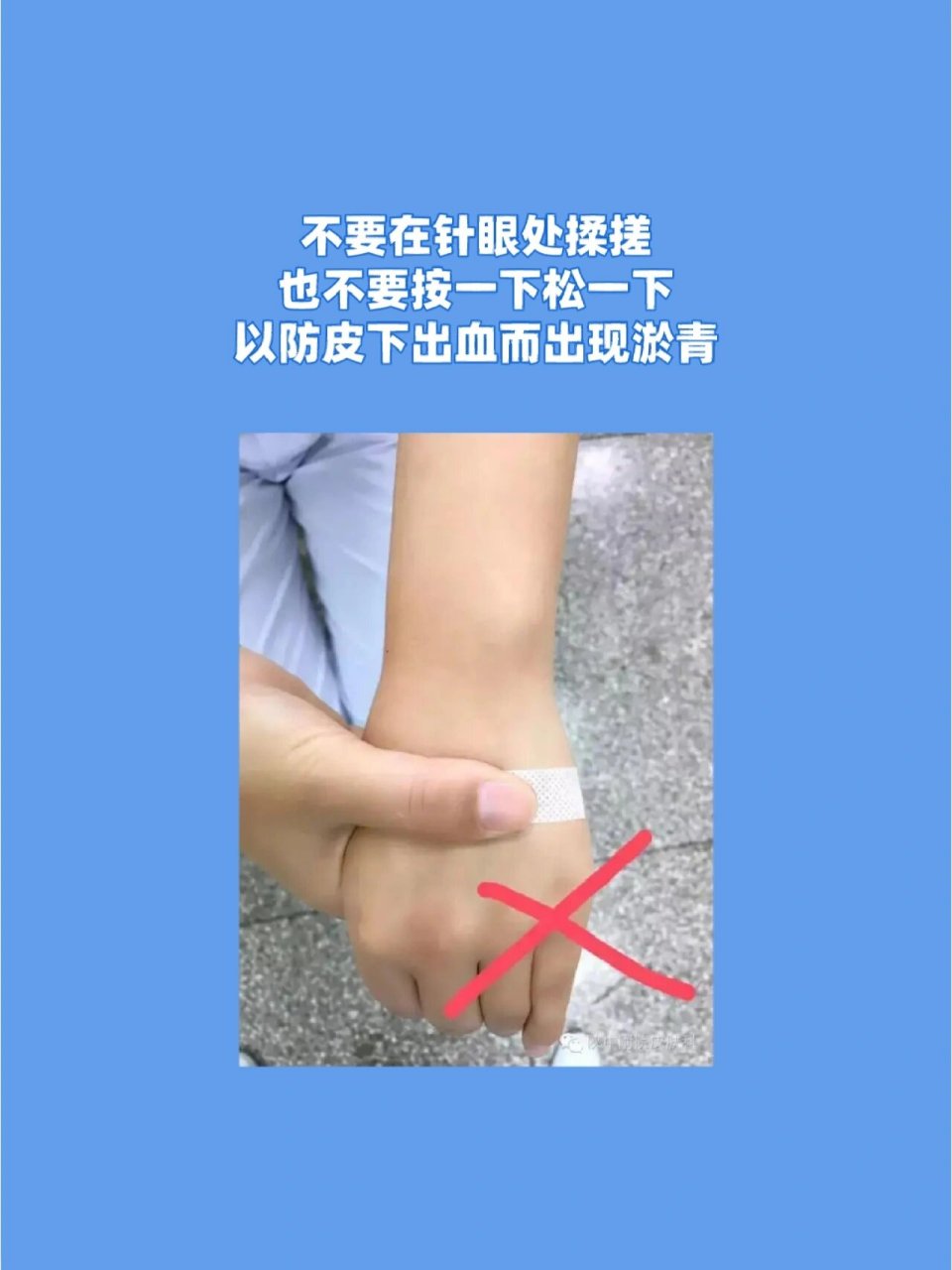 静脉输液拔针后要注意这些