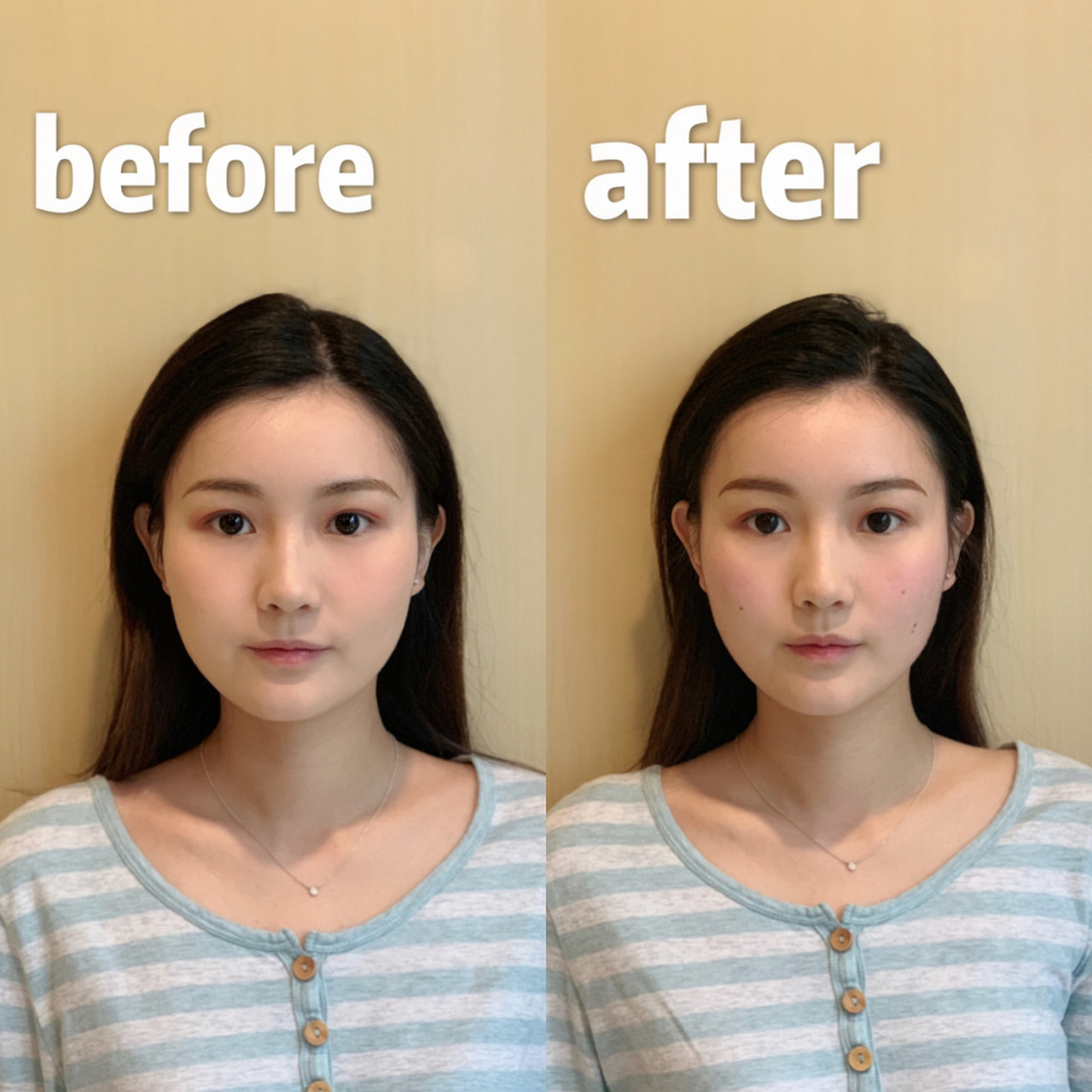 05深圳日式小颜整骨92不动刀不打针不吃药真的可以瘦脸7715