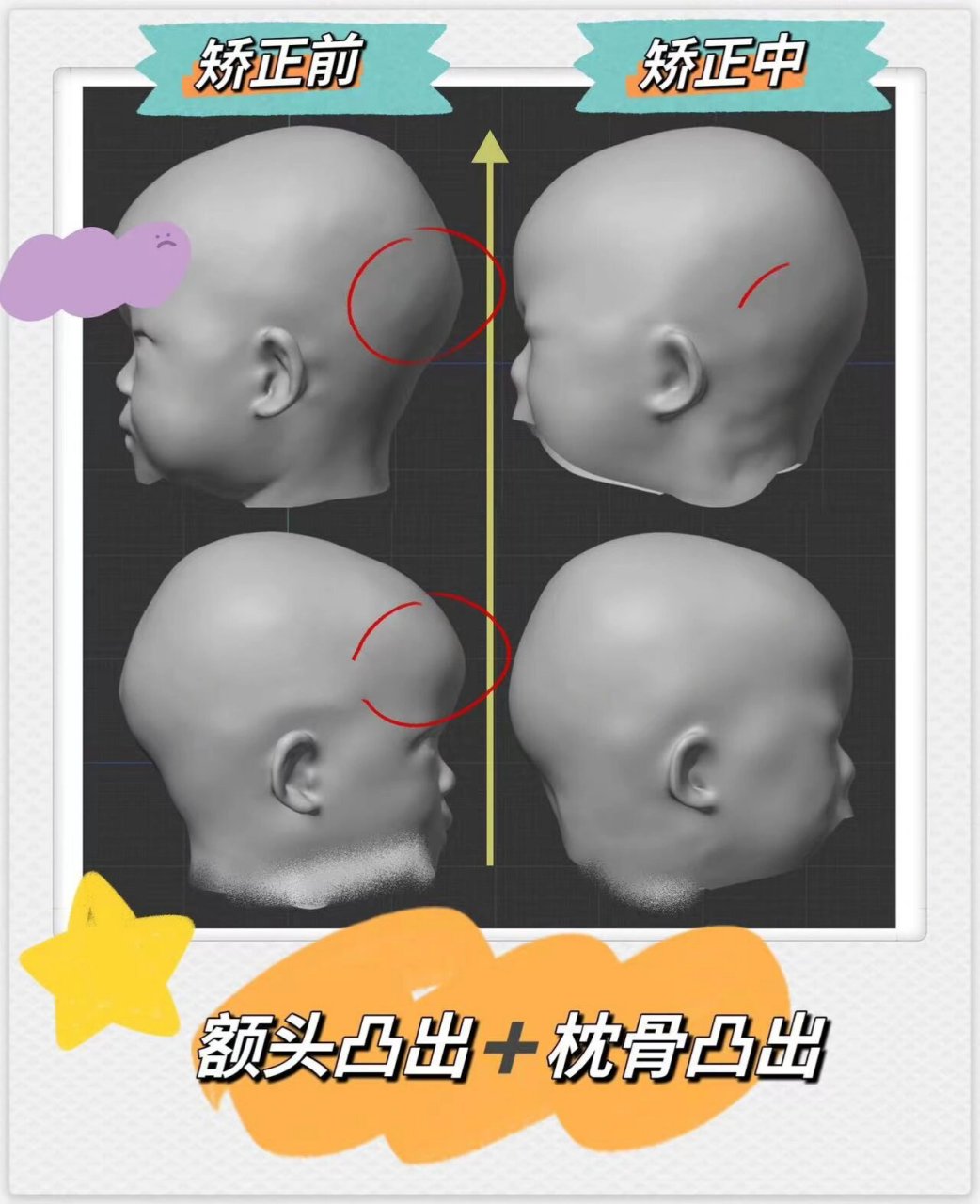 枕骨尖凸73额头凸出7491919191 73超过8个月的宝宝.