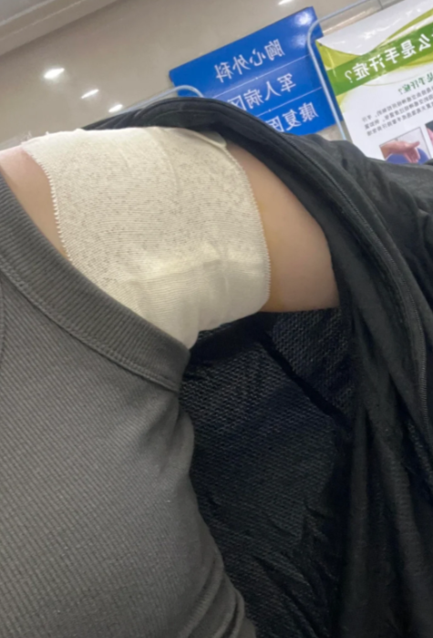 杭州腋臭治疗最新动态