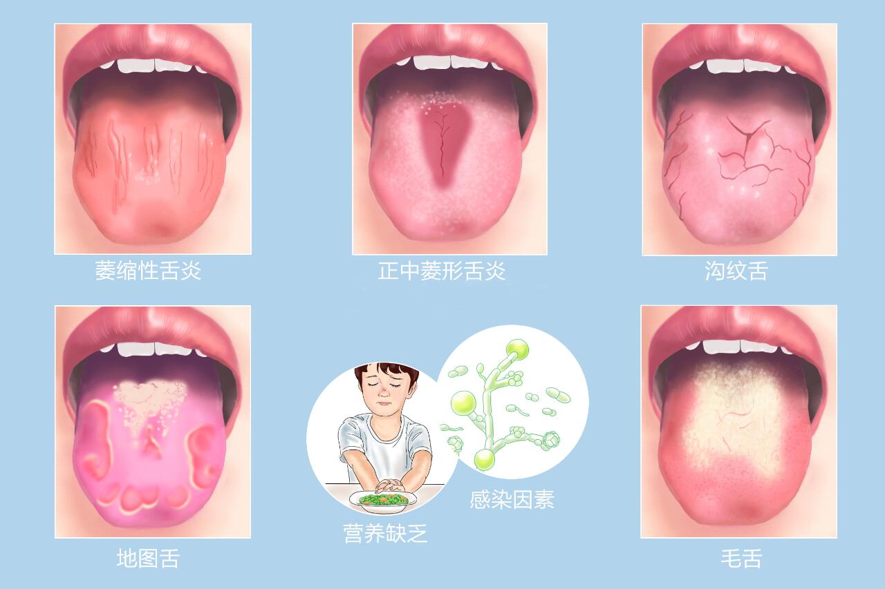 舌背位置图片